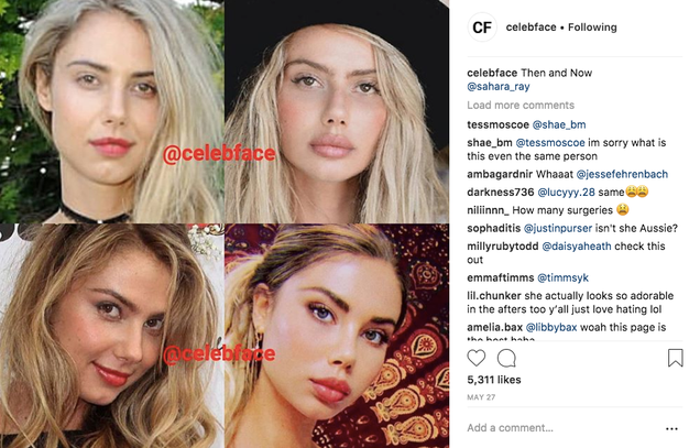 Illustration for article titled The Nipped, Tucked, and Photoshopped Revelations of Instagram's Celebface